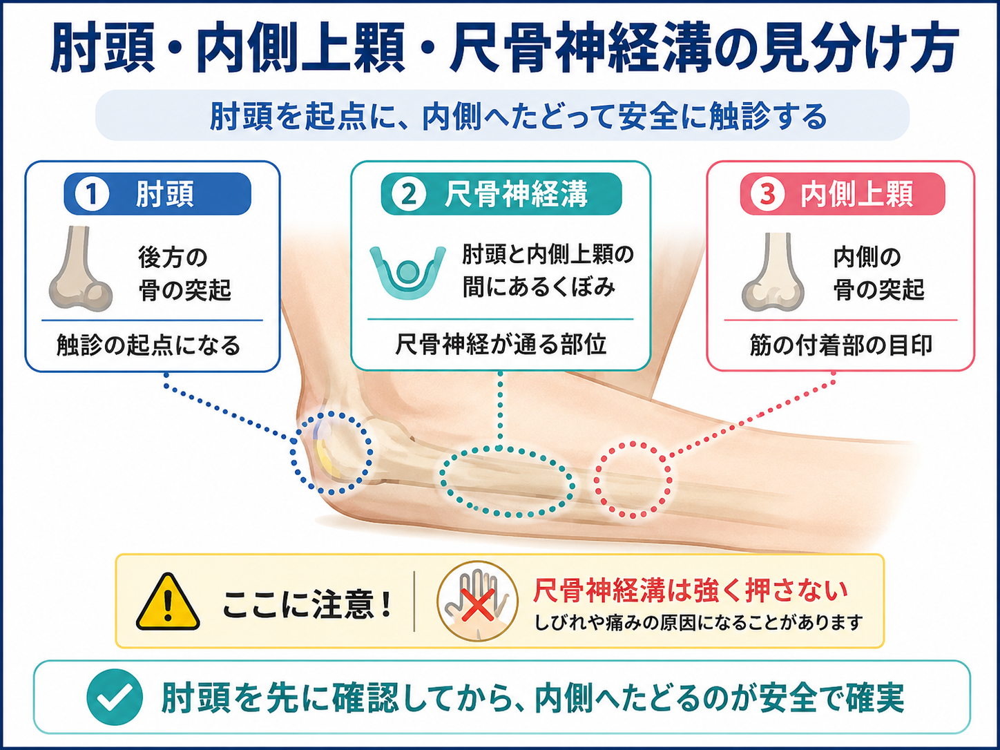 肘頭と内側上顆と尺骨神経溝の位置関係と見分け方