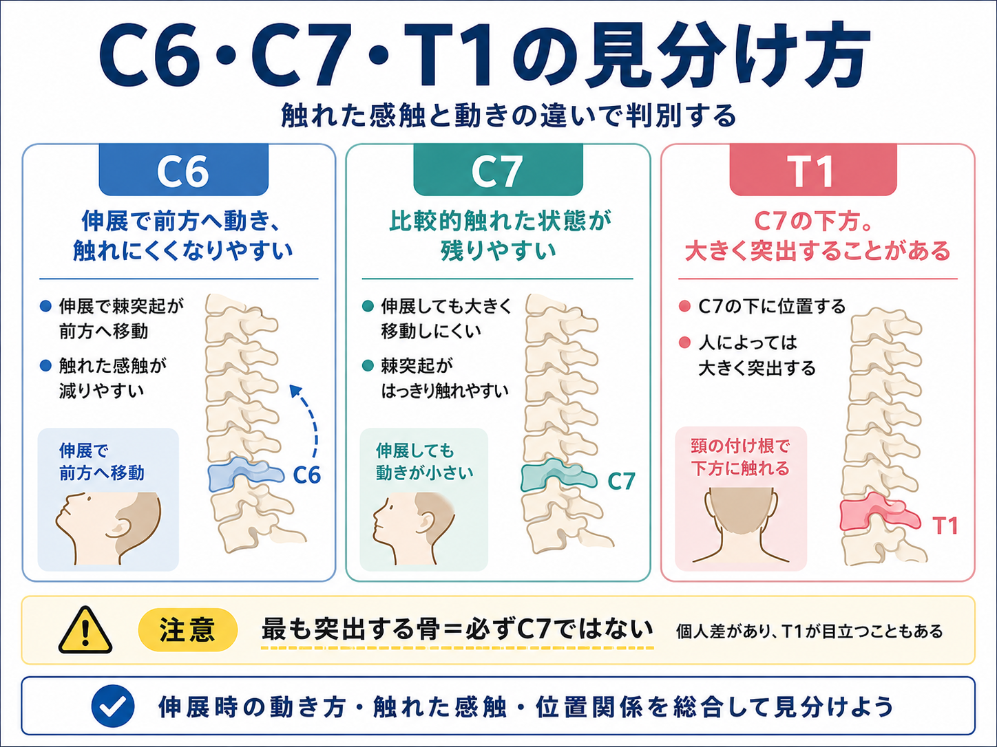 C6・C7・T1棘突起を伸展時の動きと位置関係で見分ける方法