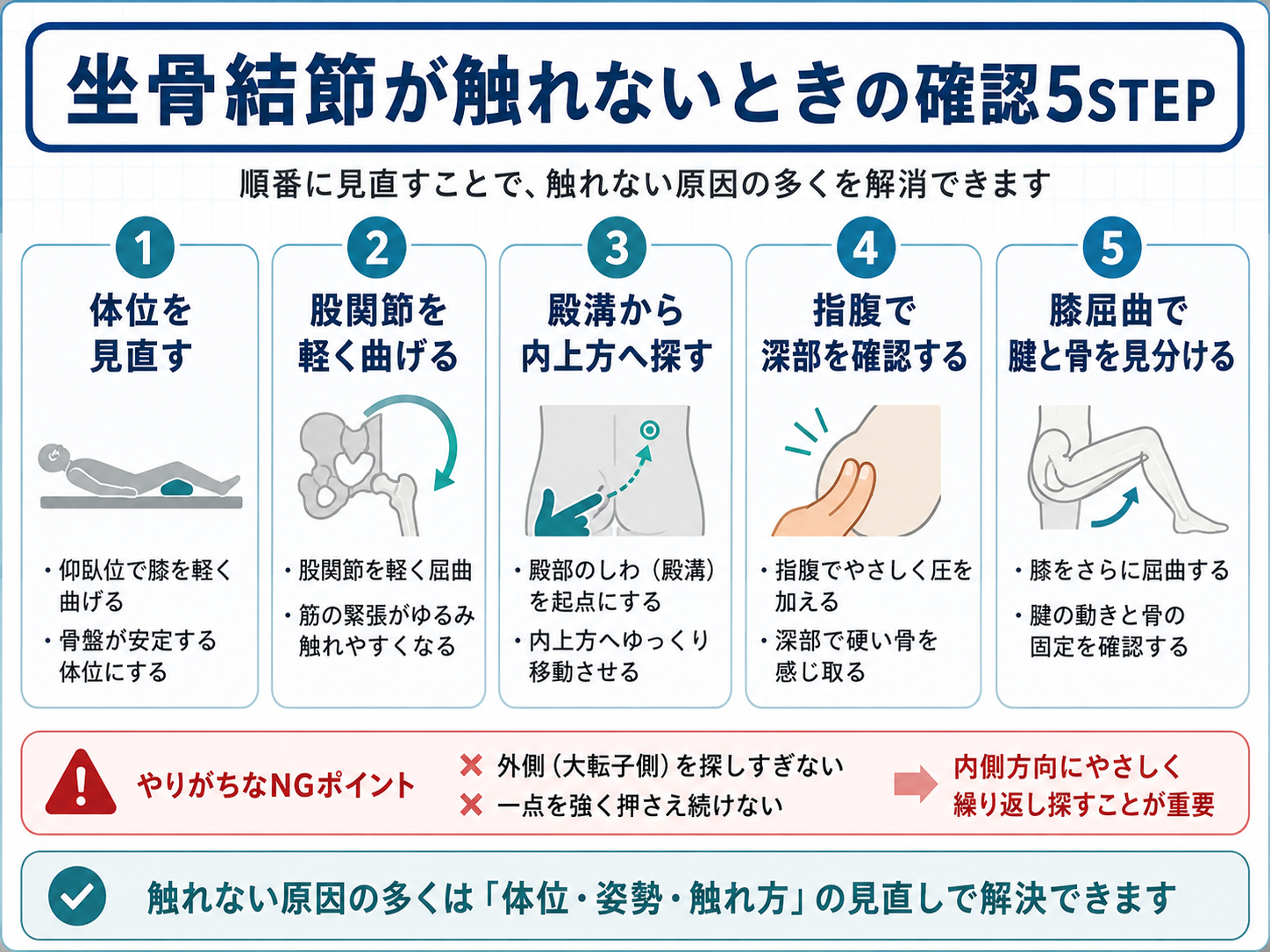 坐骨結節が触れないときに見直す5つの確認手順