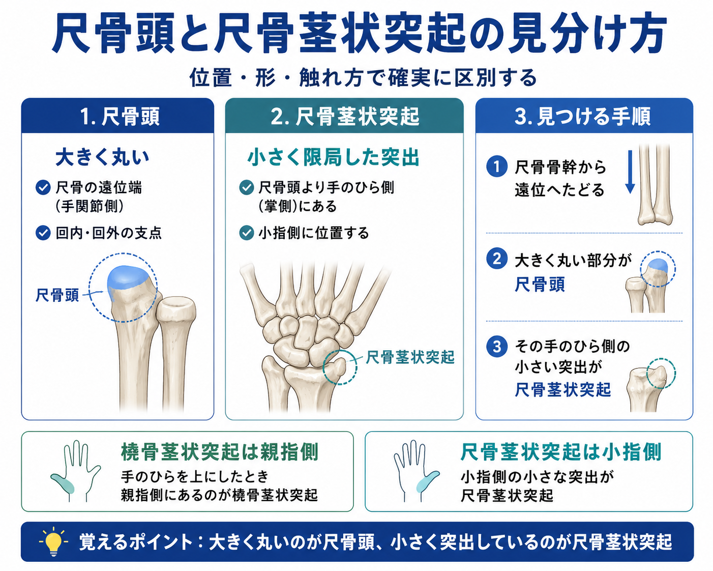 尺骨頭と尺骨茎状突起の位置や形、触診での見分け方を示した図版