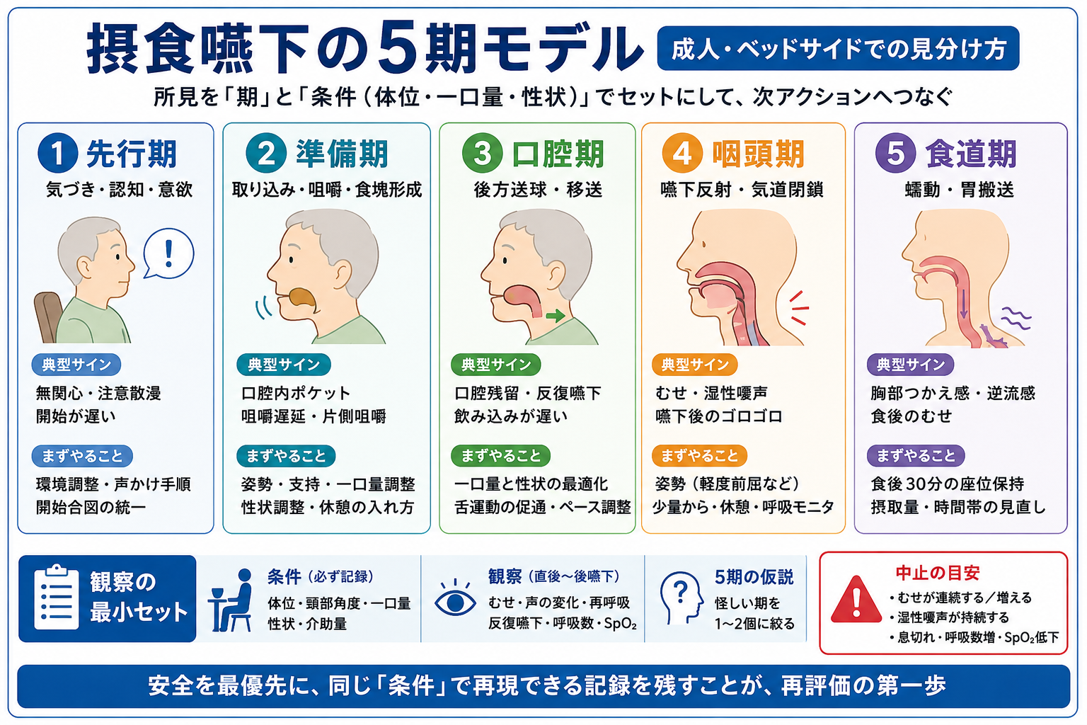 摂食嚥下5期モデルの各期の役割、典型的な観察所見、最初に行う対応、中止の目安を整理した図