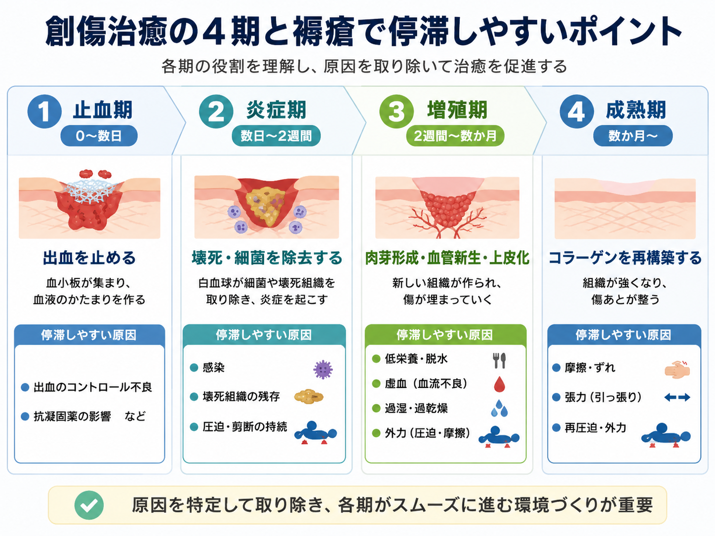 創傷治癒過程の4期と褥瘡で停滞しやすい原因を示した図