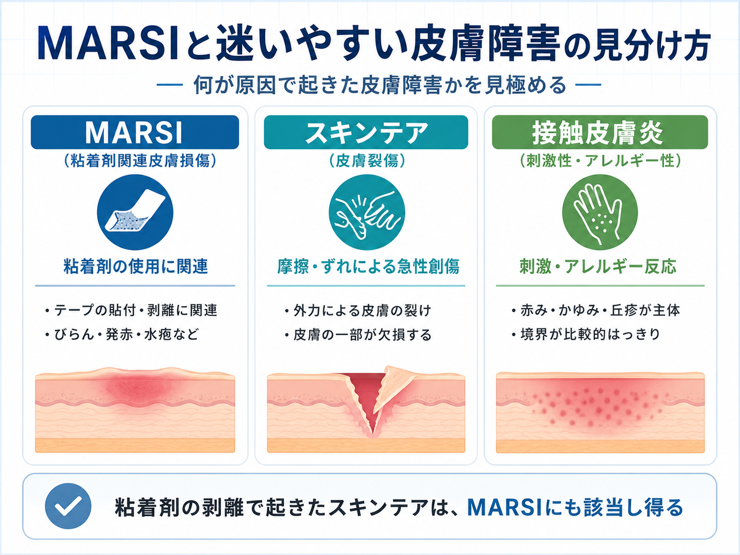 MARSI、スキンテア、接触皮膚炎の違いと見分け方。MARSIは粘着剤の使用に関連した皮膚損傷、スキンテアは摩擦やずれによる急性創傷、接触皮膚炎は刺激やアレルギー反応として整理する