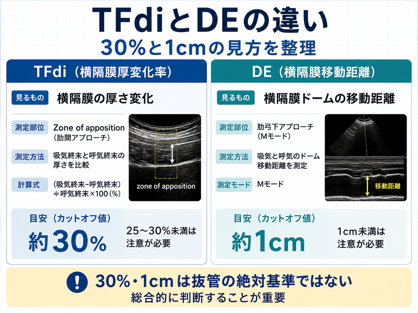 横隔膜エコーにおけるTFdiとDEの違い。TFdiはzone of appositionで横隔膜の厚さ変化を測定し約30%が離脱研究の目安、DEは肋弓下から横隔膜ドームの移動距離を測定し約1cmが目安で、いずれも抜管の絶対基準ではない