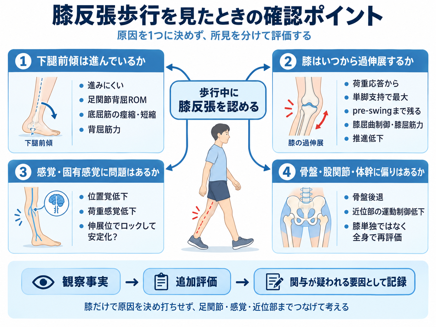 膝反張歩行を見たときの確認ポイント。下腿前傾、過伸展の出現時期、感覚・固有感覚、骨盤・股関節・体幹の4領域から原因候補を整理する図