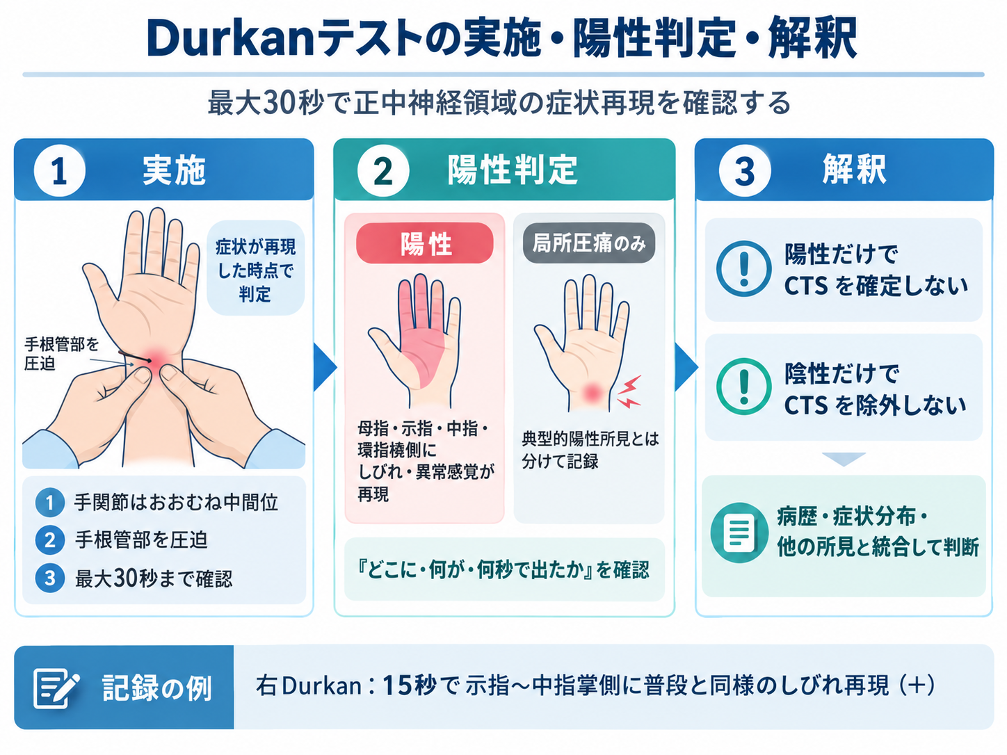 Durkanテストの実施・陽性判定・解釈。最大30秒の手根管圧迫、正中神経領域の症状再現、局所圧痛との違い、結果の解釈を示す図版