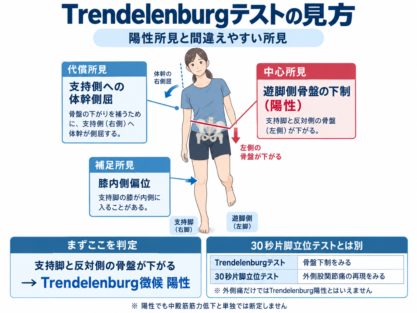 Trendelenburgテストの陽性所見と体幹側屈、膝内側偏位、30秒片脚立位テストとの違いを整理した図版