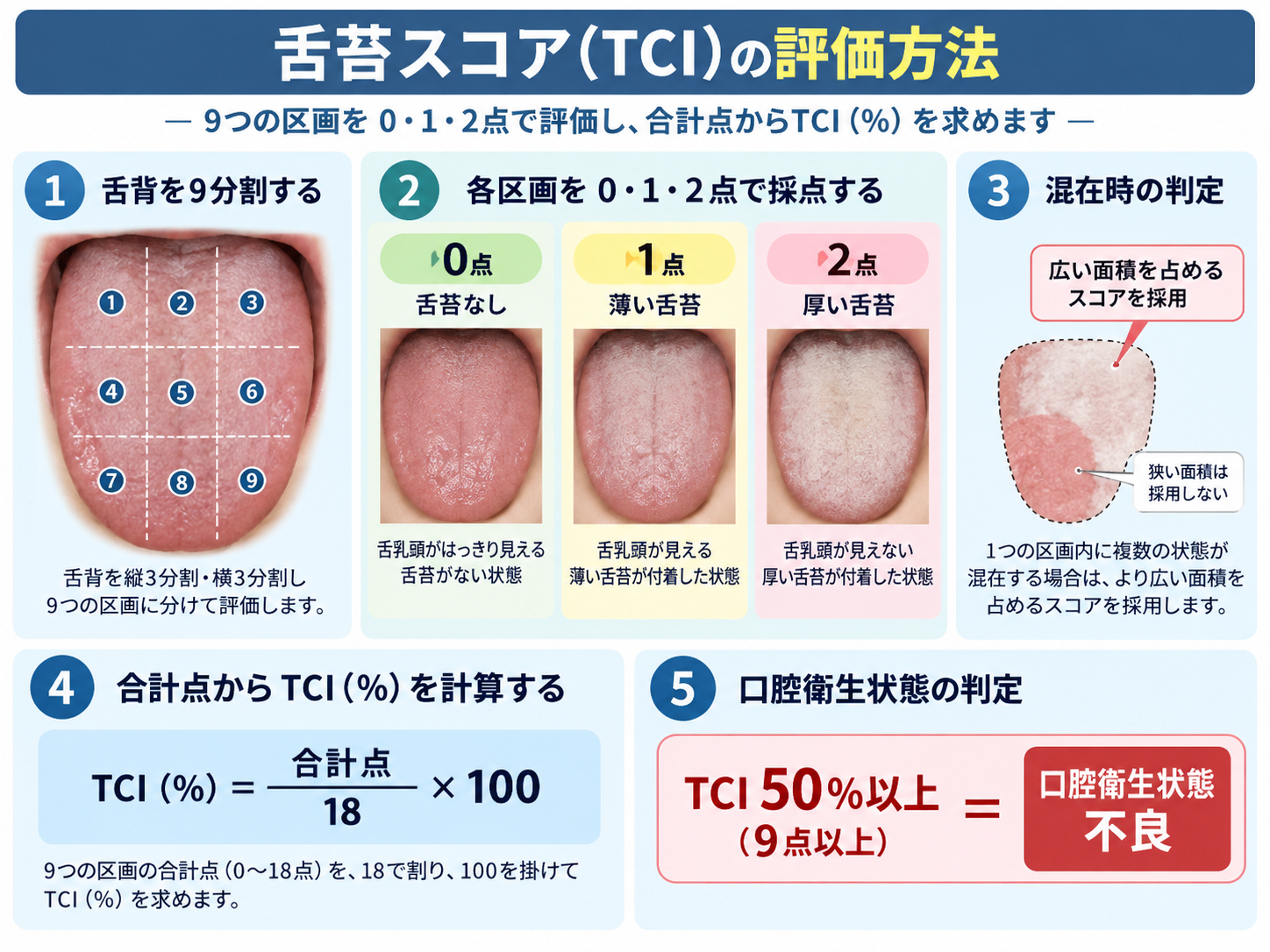 舌苔スコアTCIの評価方法を示す図。舌背を9分割し、0点・1点・2点で採点し、混在時は広い面積を占めるスコアを採用し、合計点からTCIを計算して50％以上を口腔衛生状態不良と判定する流れを示している。