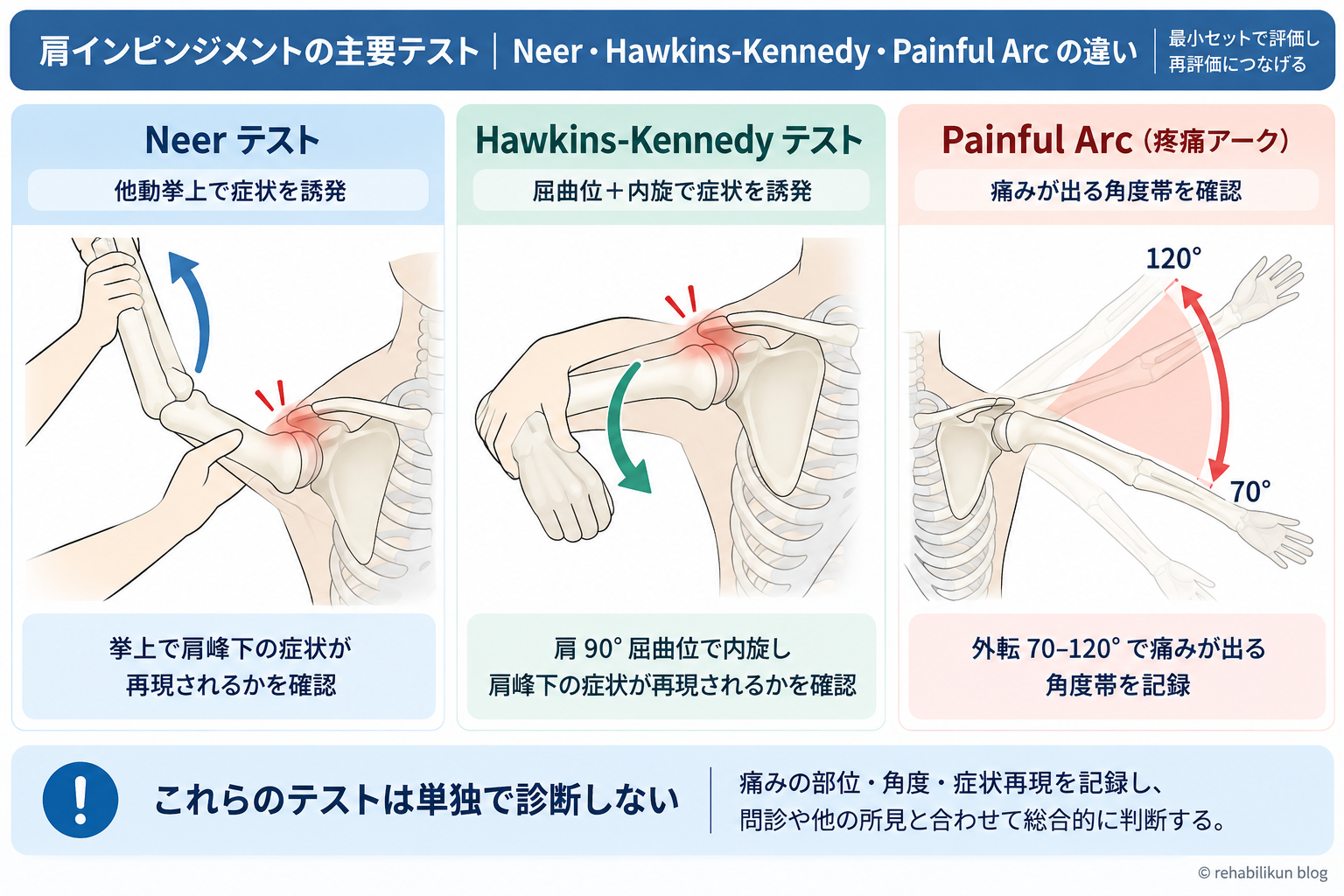 Neerテスト・Hawkins-Kennedyテスト・Painful Arcの違いと単独で診断しない考え方を示した図