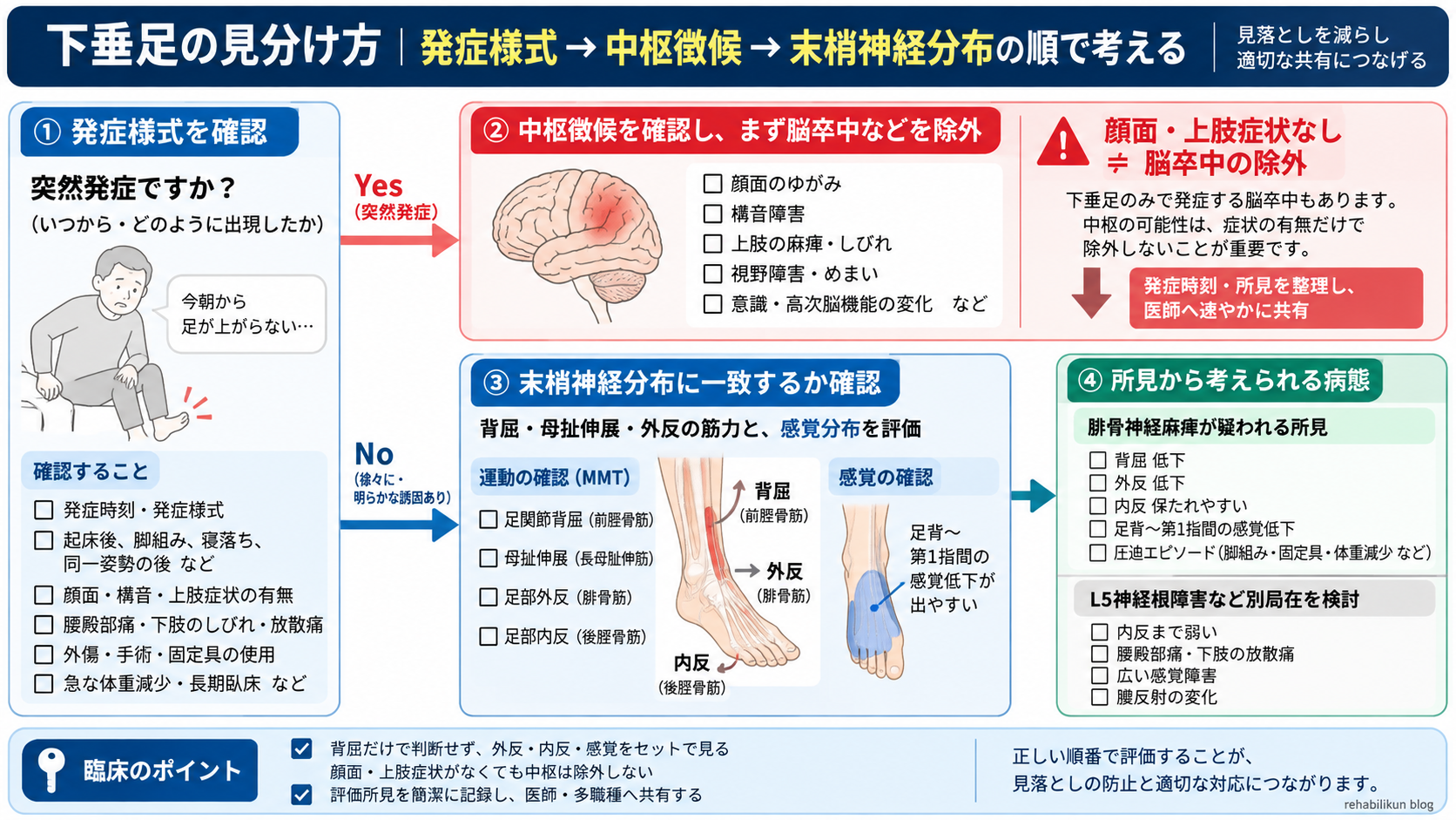 下垂足の見分け方を発症様式、中枢徴候、末梢神経分布、腓骨神経麻痺とL5神経根障害の順で整理した鑑別フロー