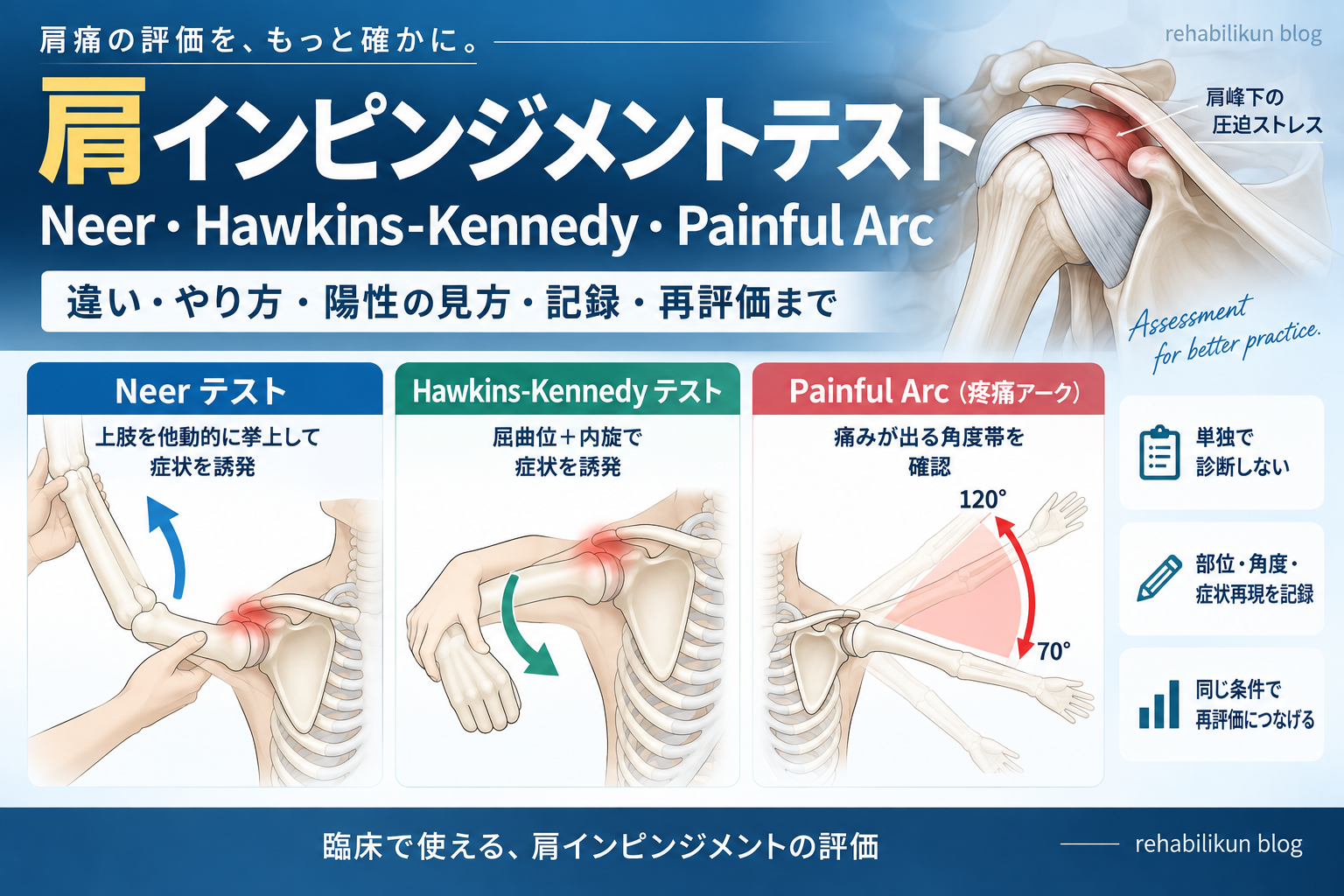 肩インピンジメントテスト|Neer・Hawkinsの違い | rehabilikun 肩インピンジメントテスト|Neer・Hawkinsの違い | rehabilikun