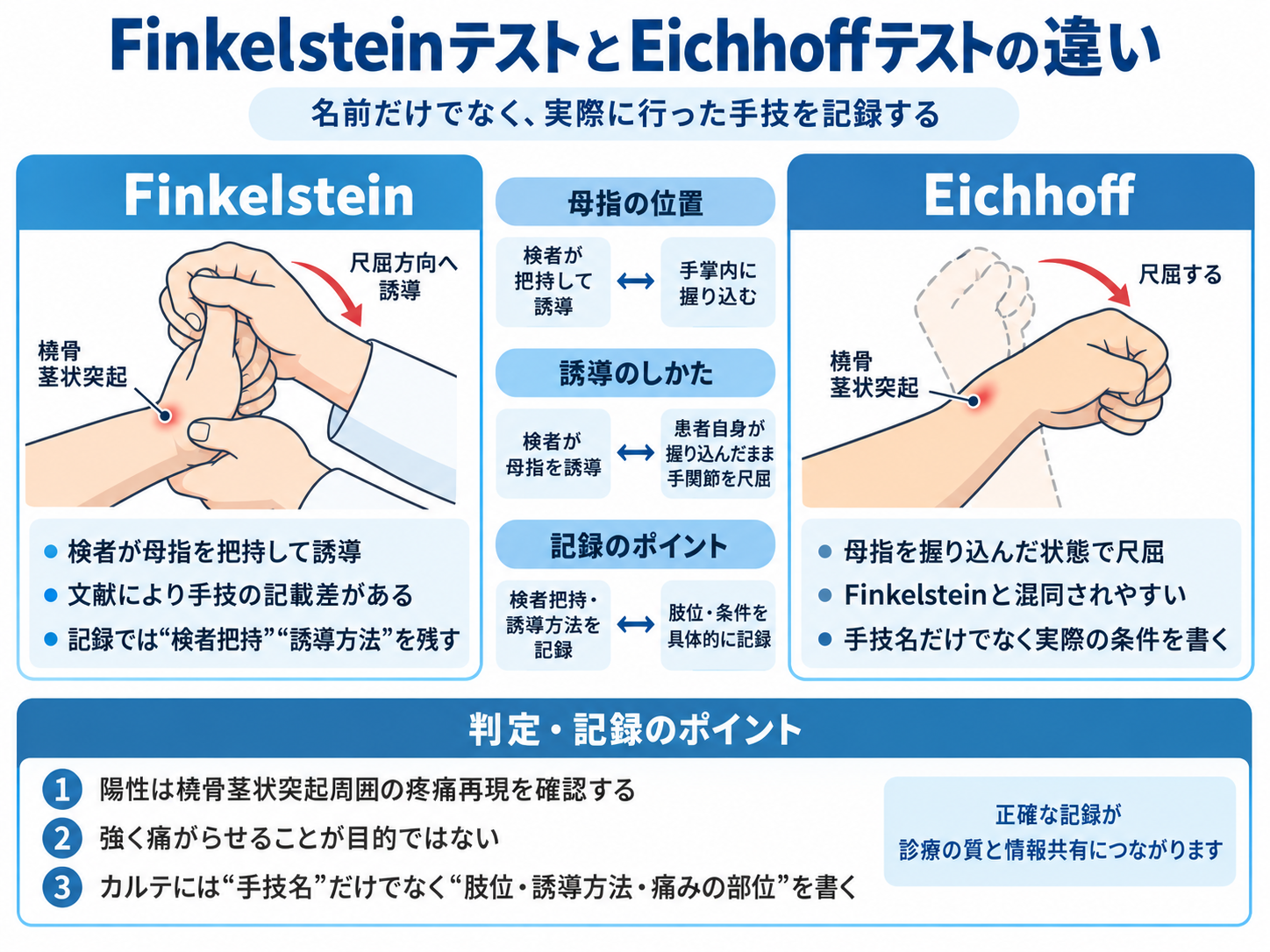 FinkelsteinテストとEichhoffテストの違い。母指の位置、誘導方法、判定と記録のポイントを比較した図