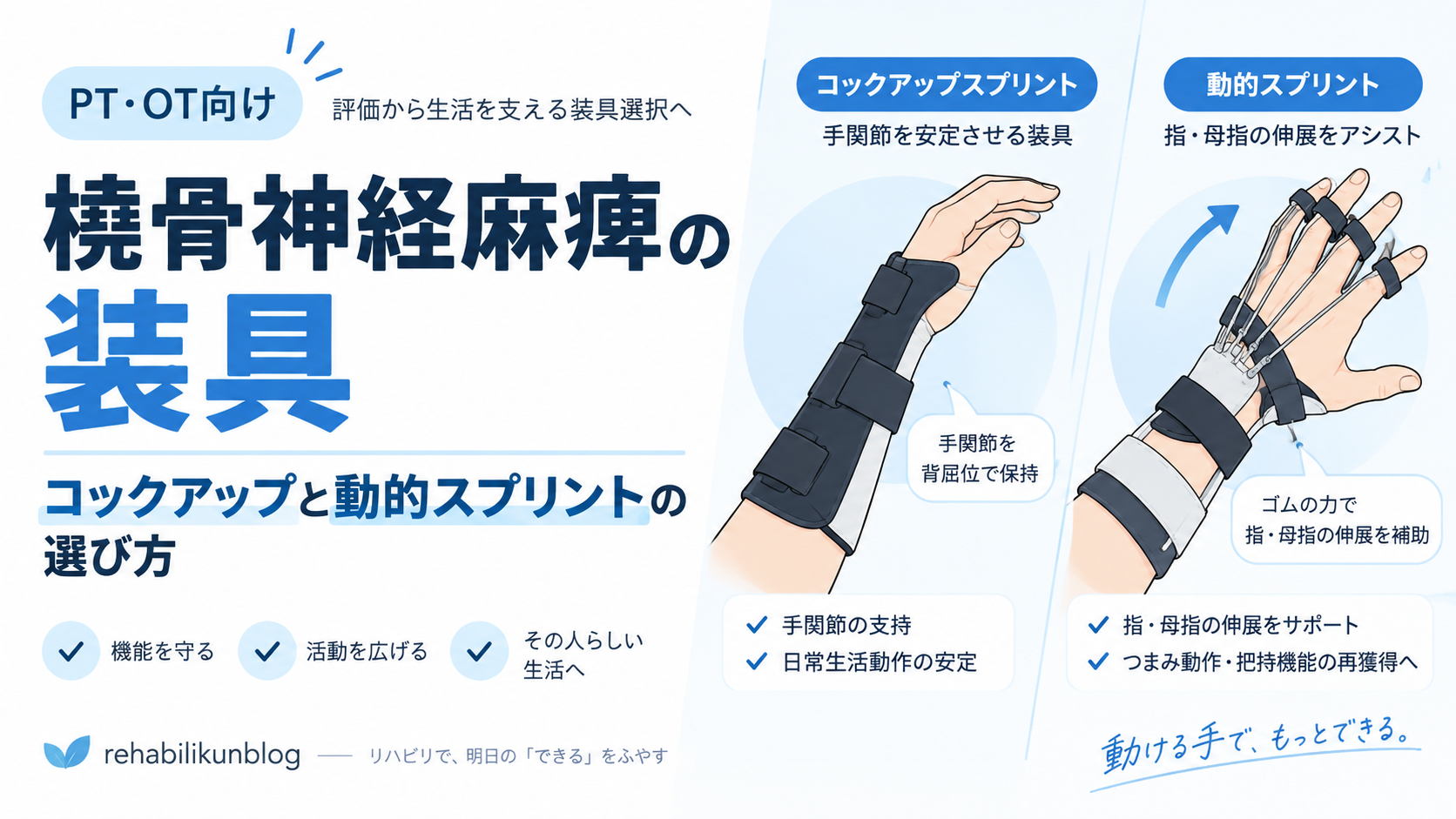 橈骨神経麻痺の装具｜コックアップと動的スプリントの選び方 | rehabilikun