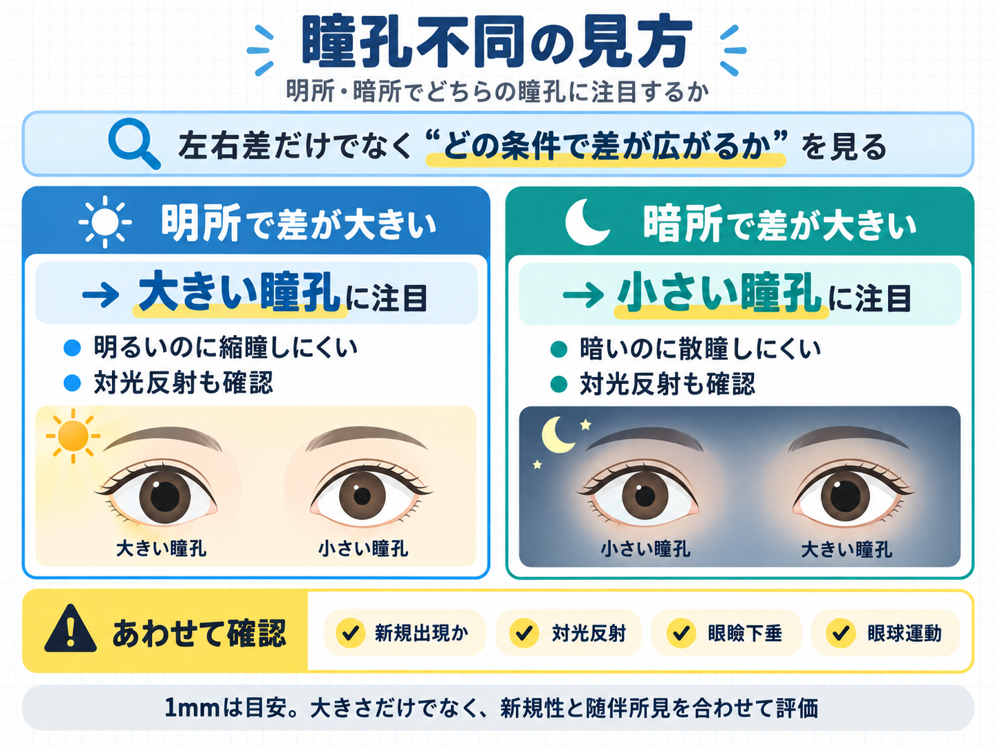 瞳孔不同の見方。明所で左右差が大きくなる場合は大きい瞳孔、暗所で左右差が大きくなる場合は小さい瞳孔に注目し、新規性・対光反射・眼瞼下垂・眼球運動も確認する流れ