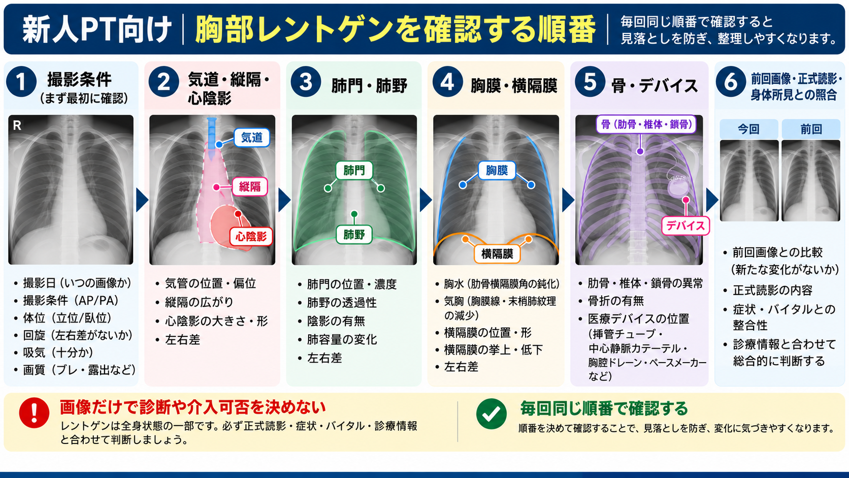 胸部レントゲンを確認する順番を示した新人PT向けフロー図