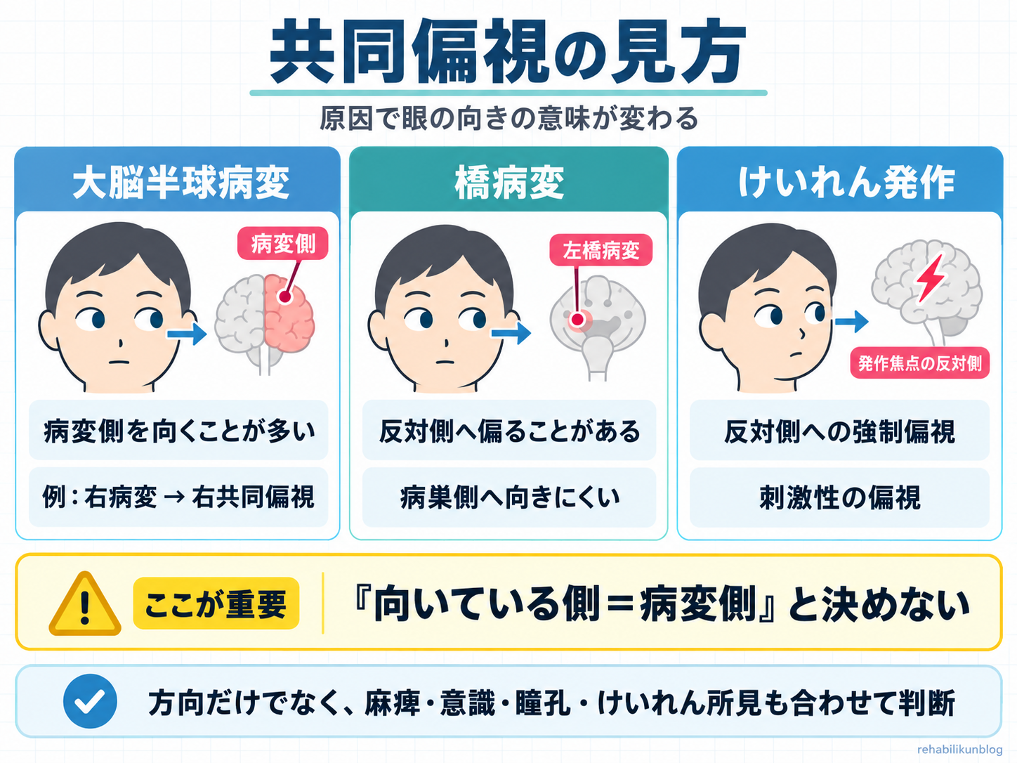 共同偏視の見方。大脳半球病変では病変側、橋病変では反対側、けいれん発作では発作焦点と反対側へ偏ることがある代表的パターンを比較した図