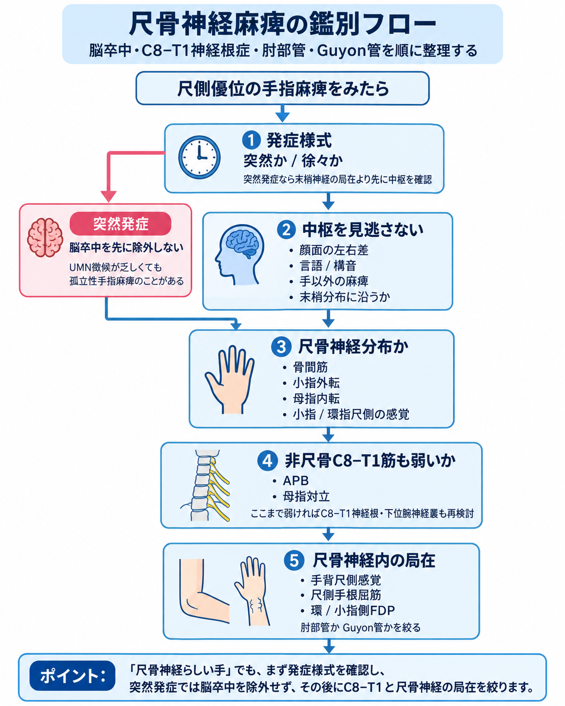 尺骨神経麻痺の鑑別フロー。発症様式から脳卒中、C8-T1神経根症、尺骨神経分布、肘部管・Guyon管の局在を順に確認する流れを示す図版。