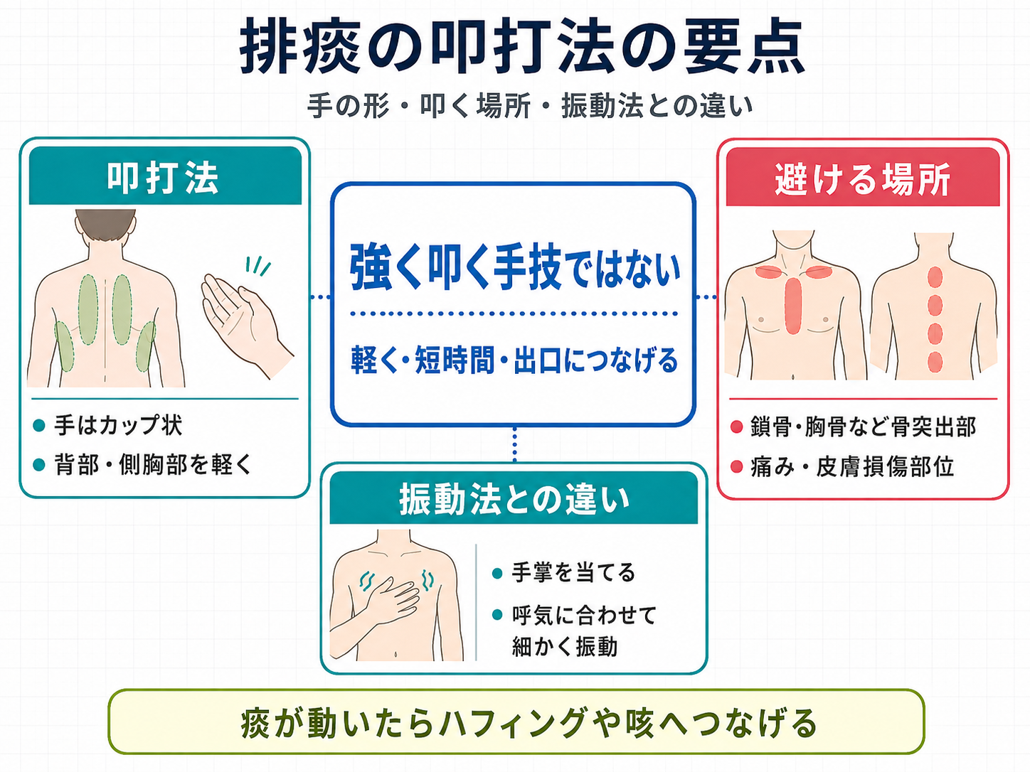 排痰の叩打法の要点。カップ状の手、背部・側胸部の実施部位、鎖骨や胸骨など避ける場所、振動法との違いを整理した図版