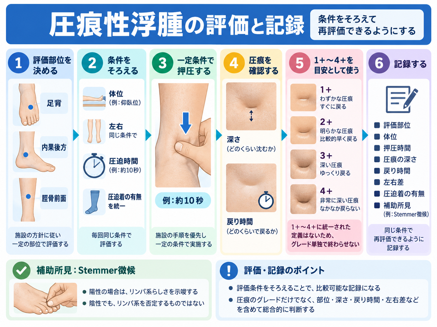 圧痕性浮腫の評価部位、条件固定、押圧、圧痕確認、1+〜4+の目安、記録までを示した図