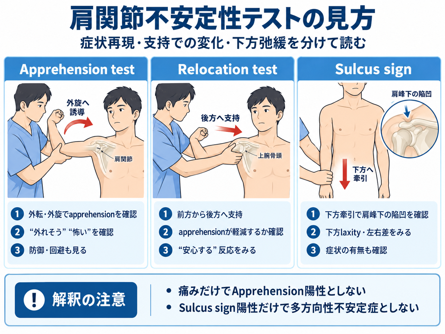 肩関節不安定性テストの見方。Apprehension testは症状再現、Relocation testは後方支持での変化、Sulcus signは下方弛緩を確認する図版