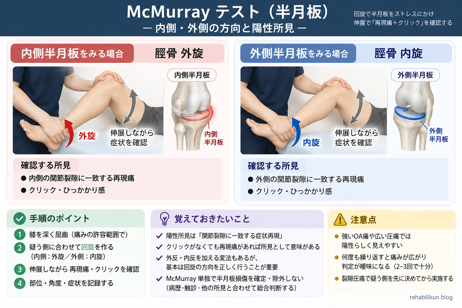 McMurrayテストの内側半月板と外側半月板の回旋方向、陽性所見を整理した図版